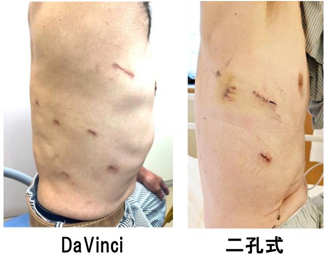 呼吸器外科 | 地方独立行政法人山梨県立中央病院
