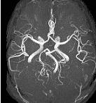 頭部血管画像