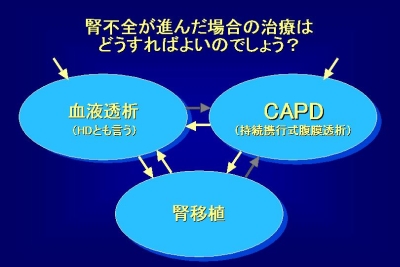 腎不全が進行した場合の治療